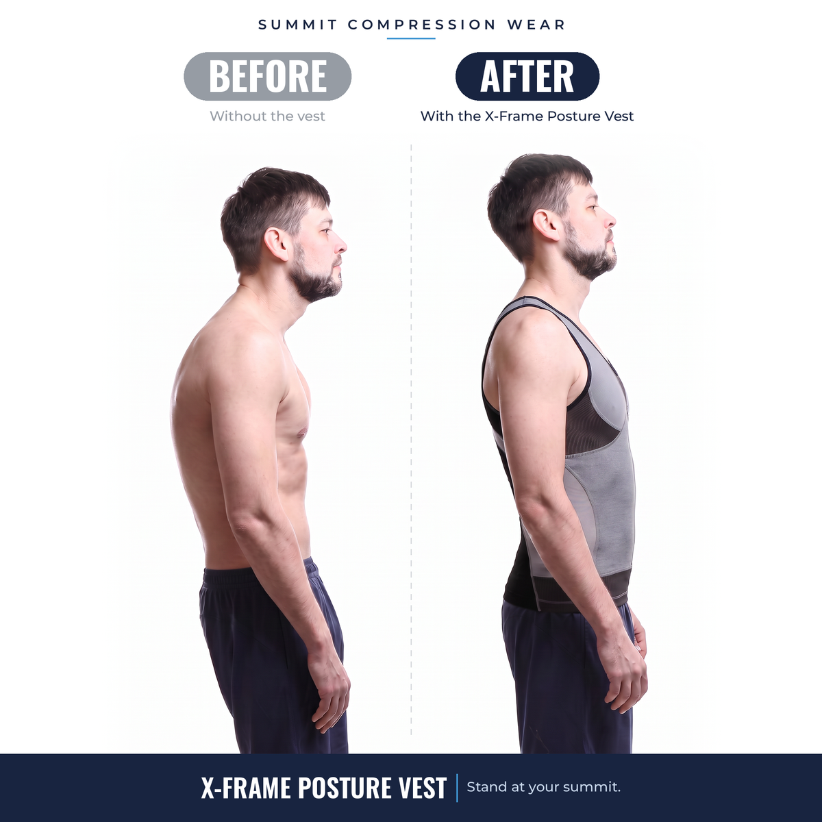 X-Frame Posture Vest – Stand Taller, Look Broader